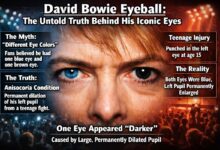 david bowie eyeball​